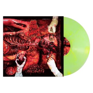 200 Stab Wounds - Manual Manic Procedures (plutonium green & yellow marble) LP